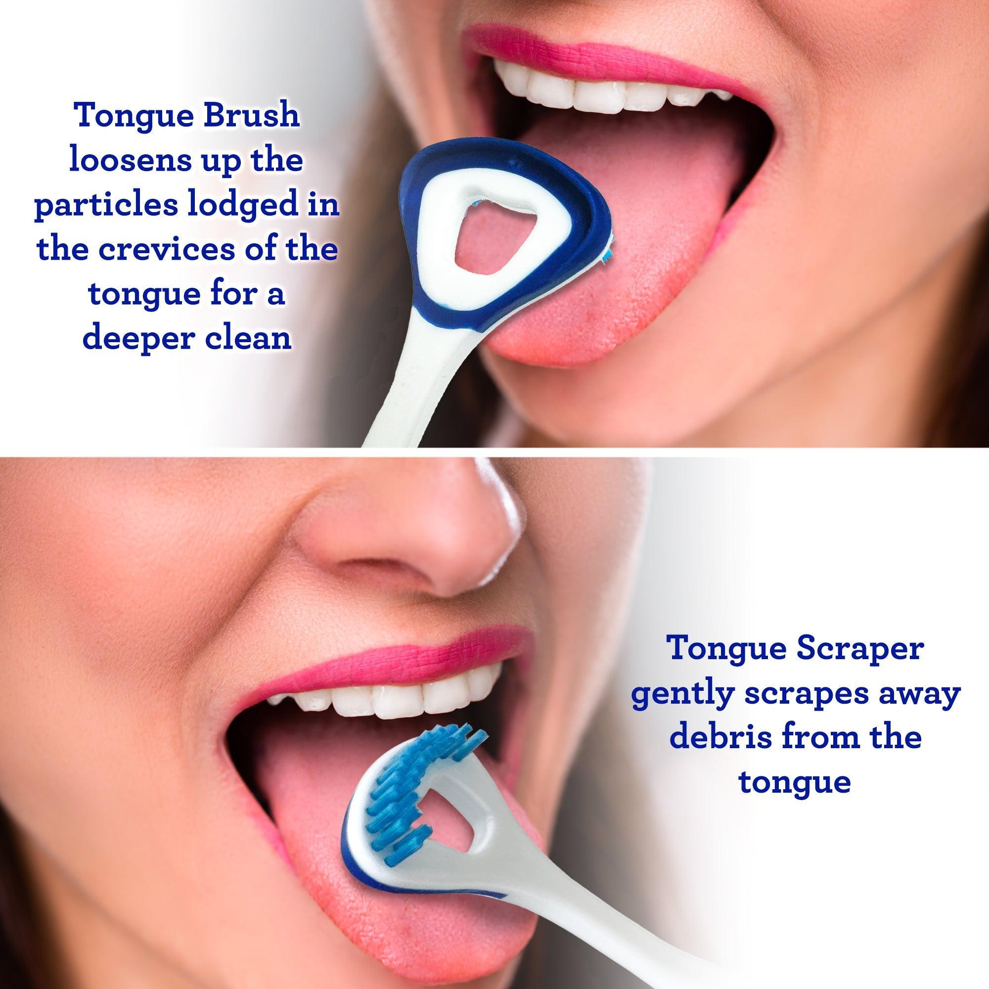 Dual Action Tongue Cleaner ¨C 1 Pack (Colors May Vary)