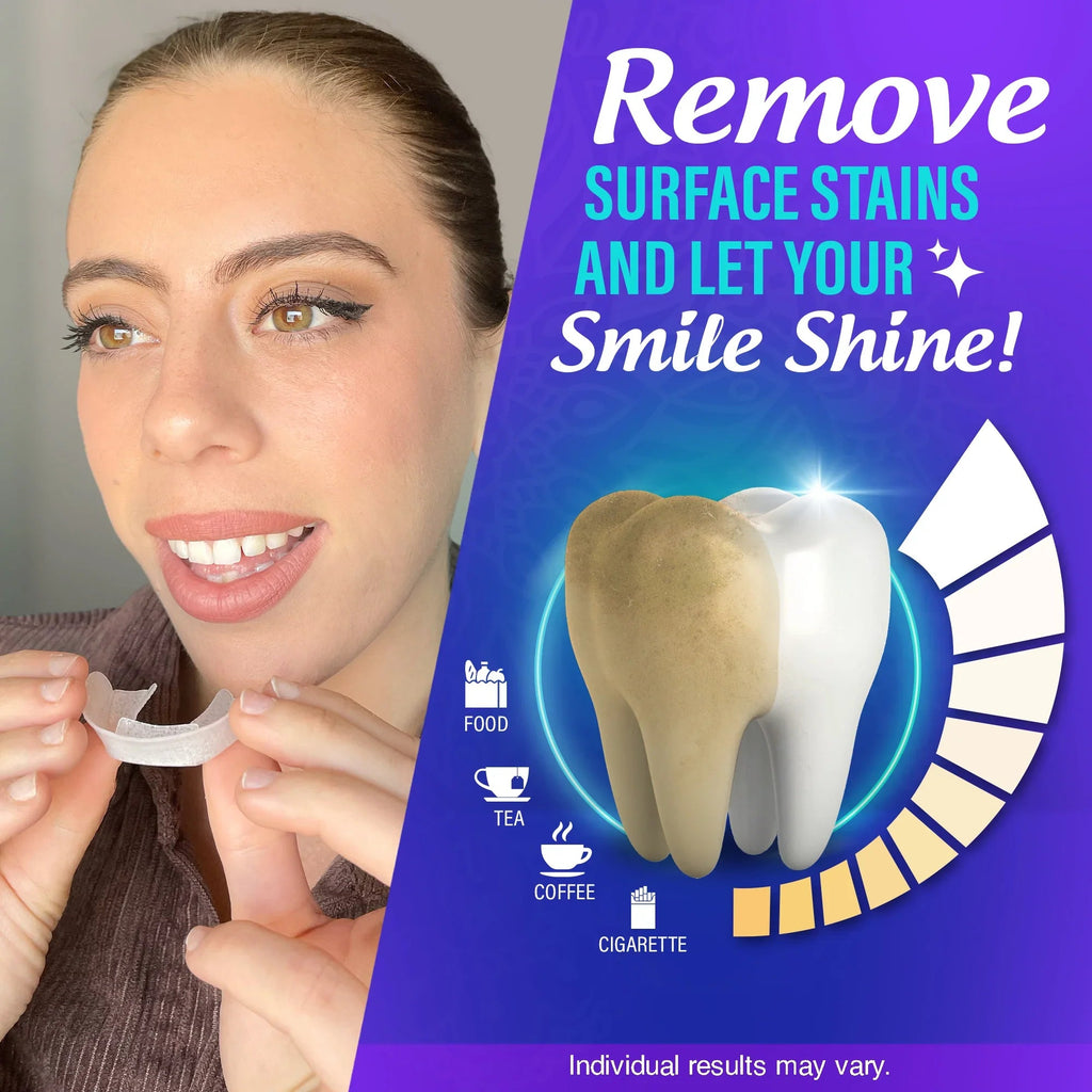 Professional Whitening Trays ¨C 7 Treatments