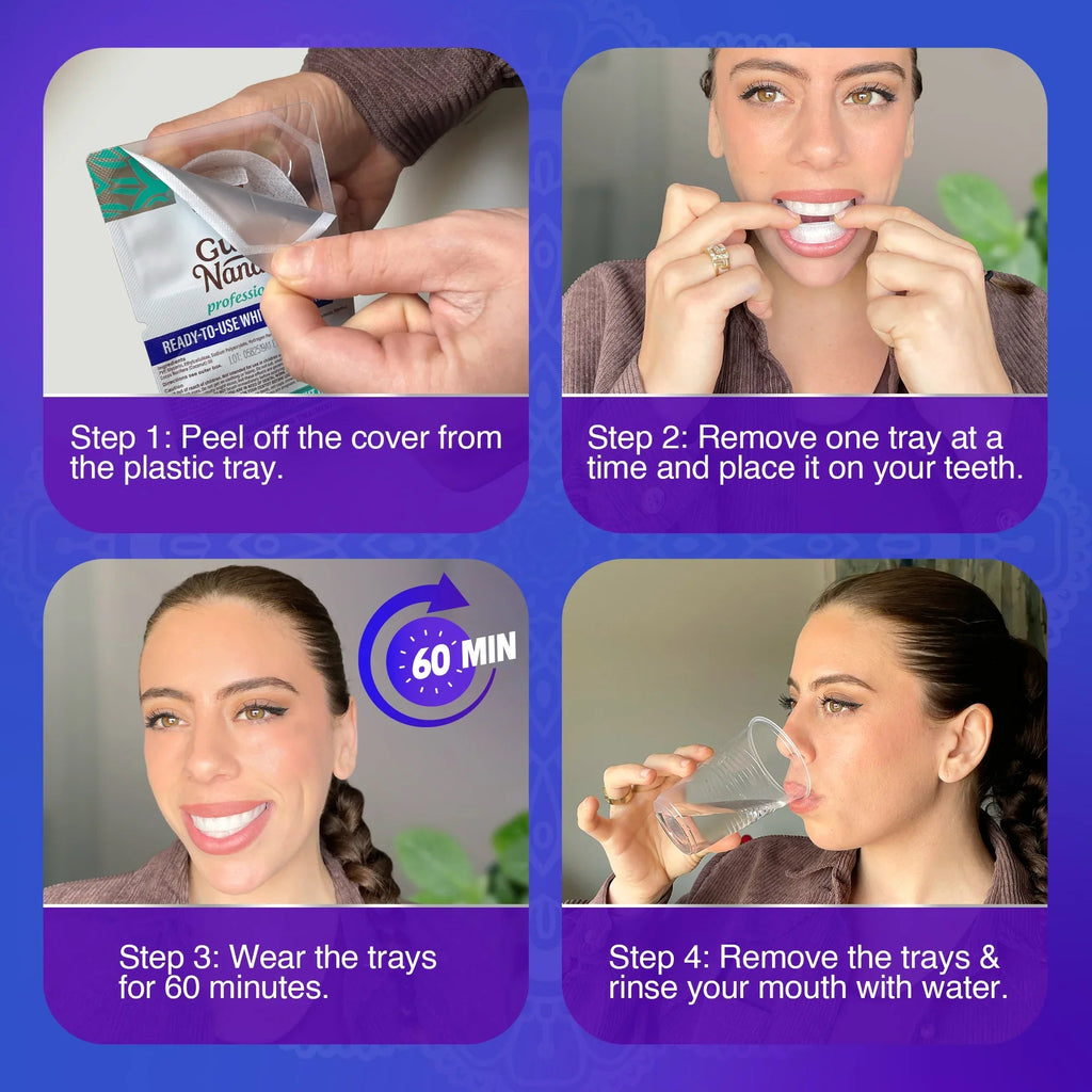Professional Whitening Trays ¨C 7 Treatments