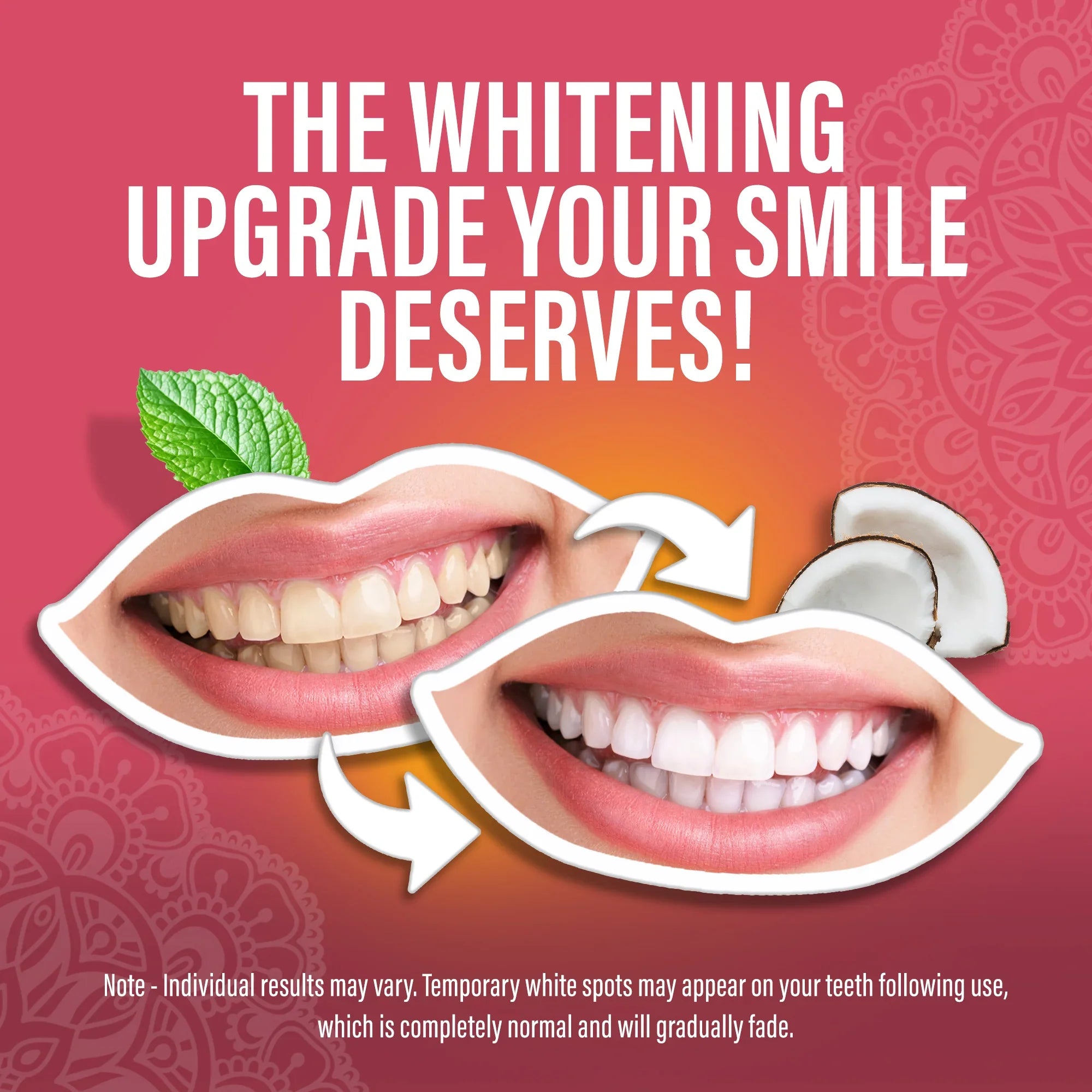 Sensitive Whitening Strips ¨C 9 Day Treatment