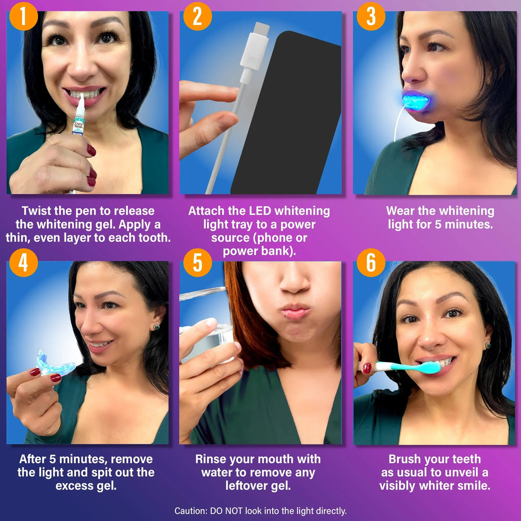 Wired LED Teeth Whitening Kit