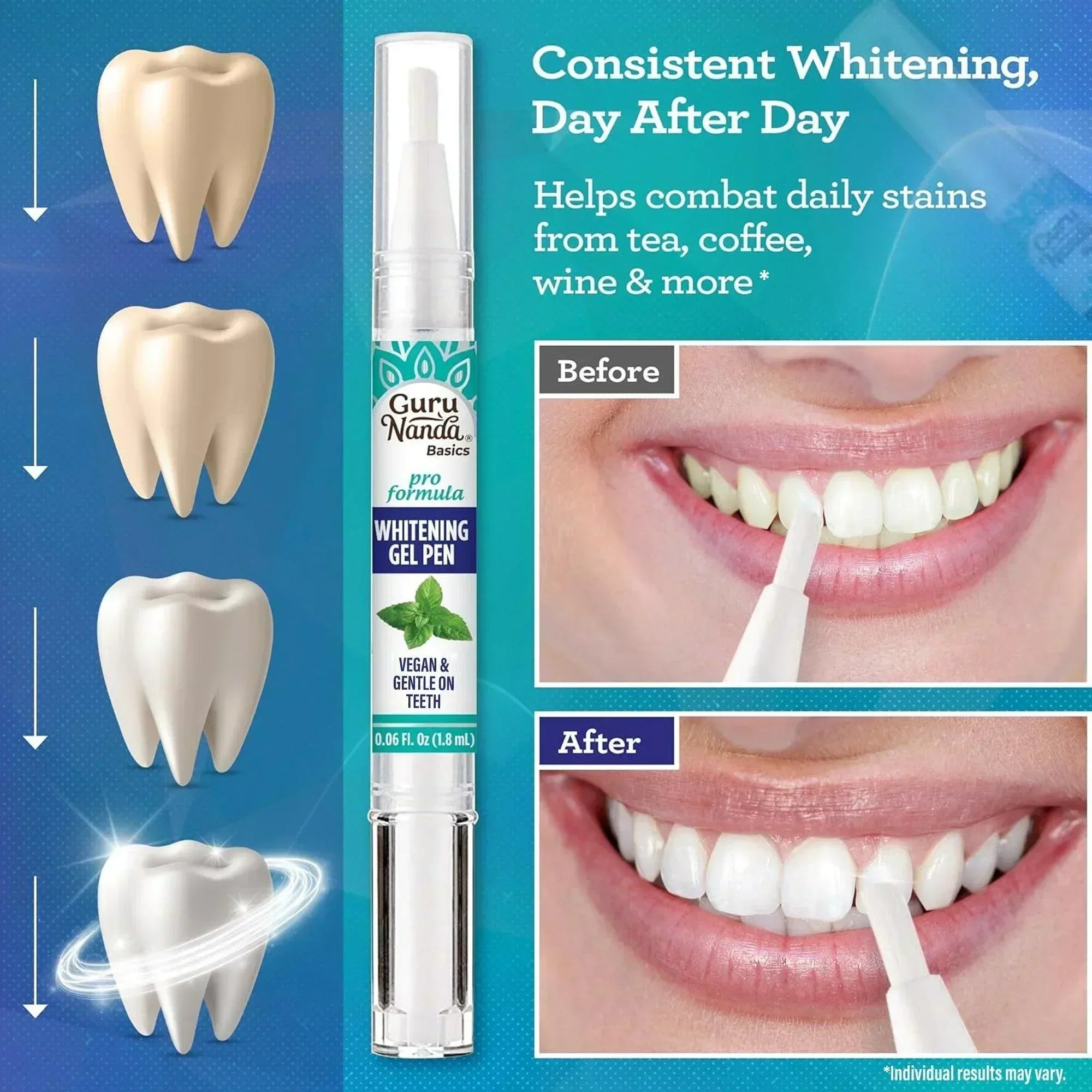 Whitening Gel Pen ¨C 1.8mL